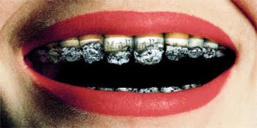 ¿Sabes los efectos del tabaco en la salud dental?